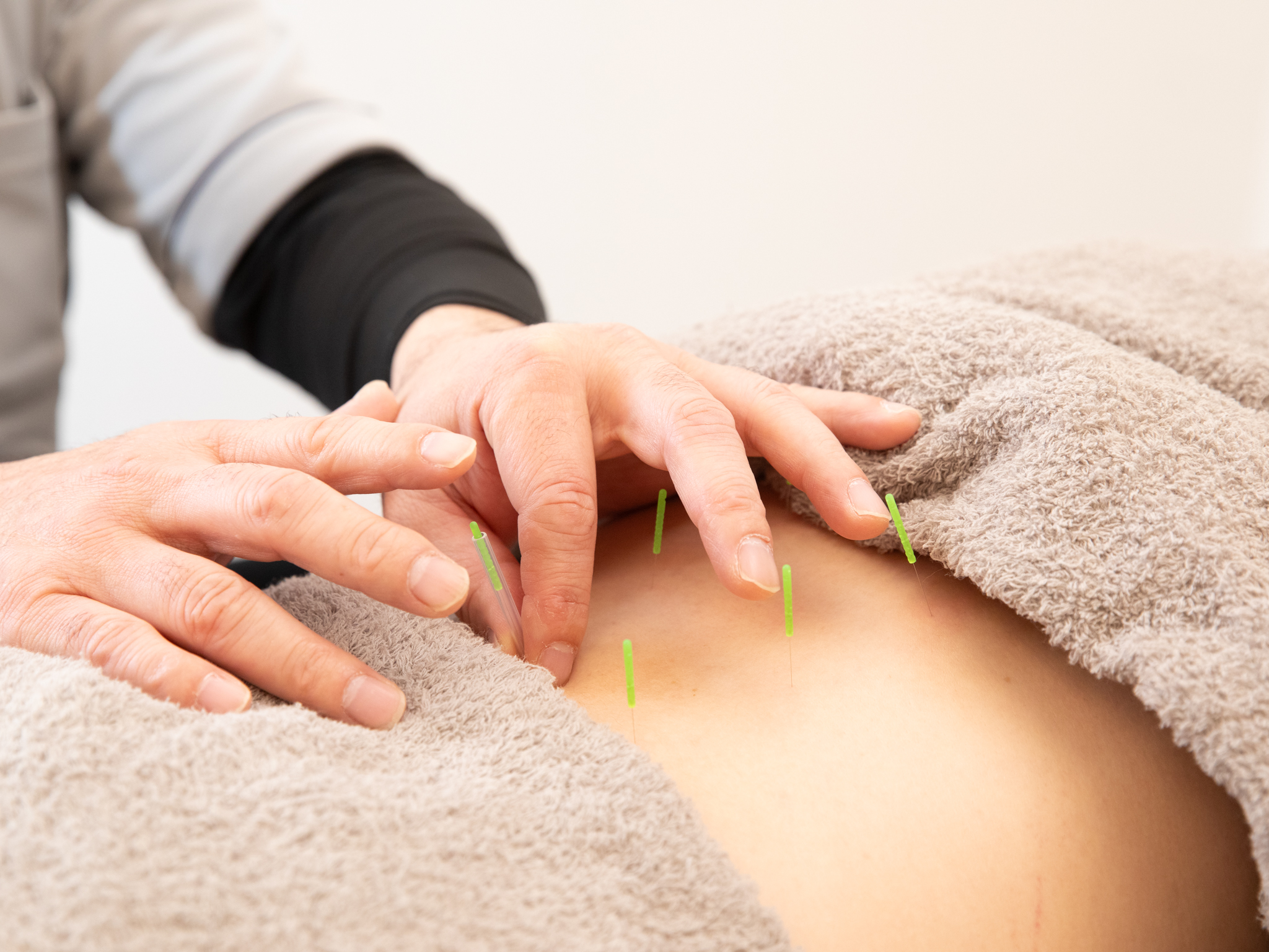 施術内容 鍼灸施術
草加駅から徒歩5分 りふぁいん鍼灸院 整骨院